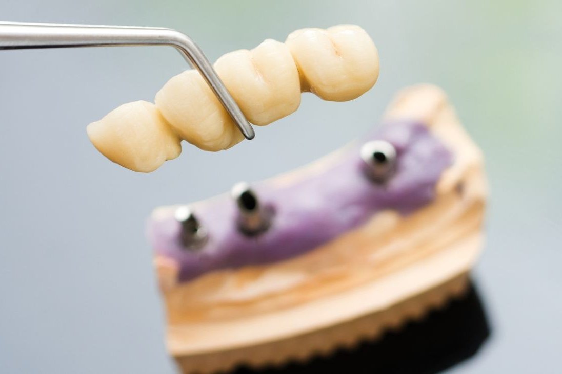 Diploma of Dental Technology